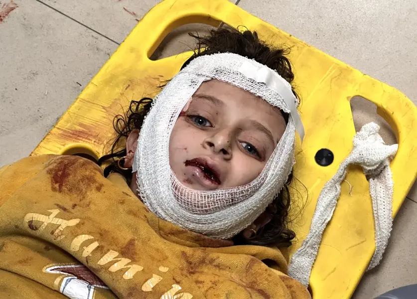 An injured Palestinian girl is taken to Al-Aqsa Martyrs Hospital for medical treatment following Israeli army attack on Nasirat Refugee Camp in Deir el-Balah, Gaza on December 21, 2023. [Ashraf Amra/Anadolu Agency]
